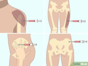 how-to-administer-b12-injection_1753700662
